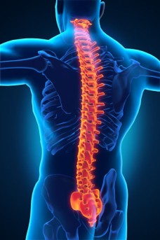Cervical Spine Fusion by OrangeCountySurgeons